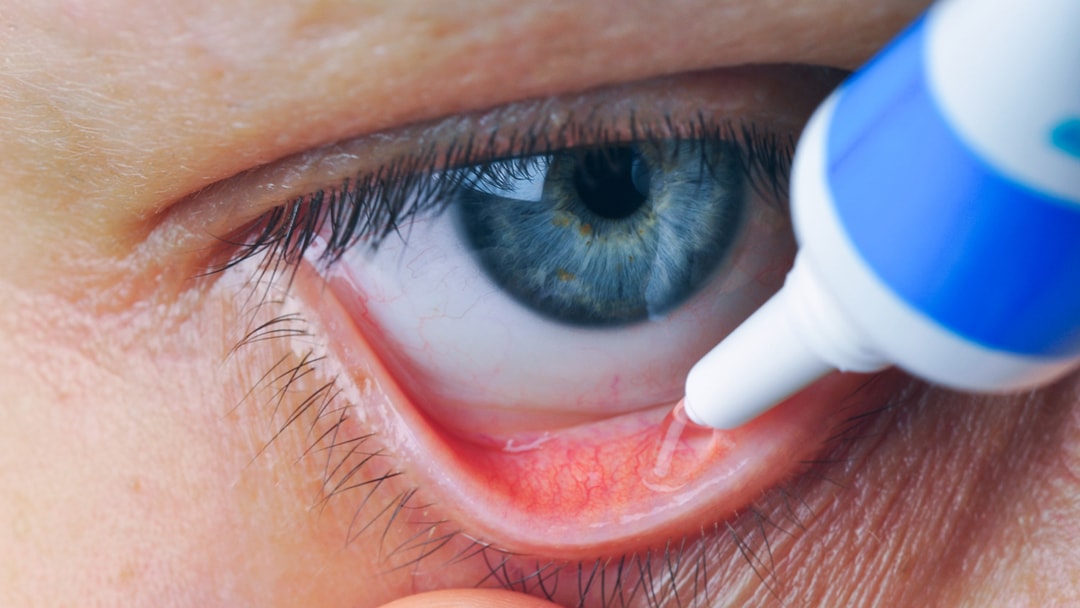 How to put in eye drops Clearly Blog Eye Care & Eyewear Trends