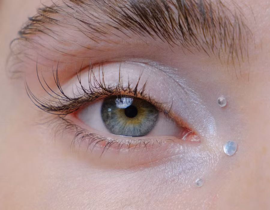 What causes grey eyes?